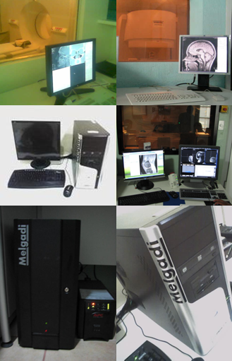 Equipos Melgadi